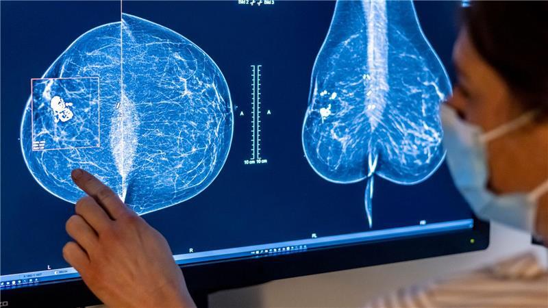 2023 wurden rund eine halbe Million Menschen in Deutschland mit Krebs diagnostiziert. (Symbolbild)