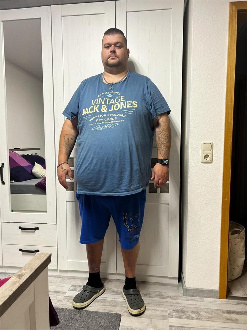 „Mein Fuß lag anderthalb Meter neben mir“: Bennys Kampf zurück 230 Kilogramm wiegt Benjamin Schneider im Oktober 2022, kurz bevor die Magenoperation sein Leben verändern soll.