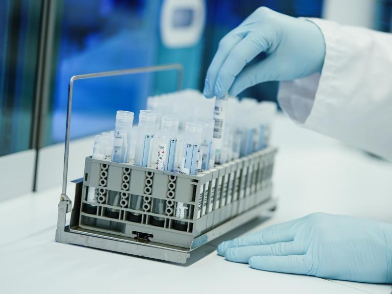 Am Wochenende werden die positiven Testergebnisse aus dem Landkreis Stade nicht an das Robert Koch-Institut übermittelt. Foto: Uwe Anspach/dpa