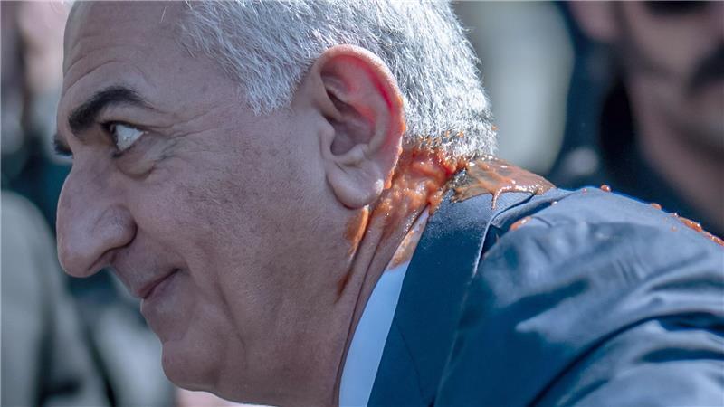 An Hals und Schulter bespritzt: Reza Pahlavi.  