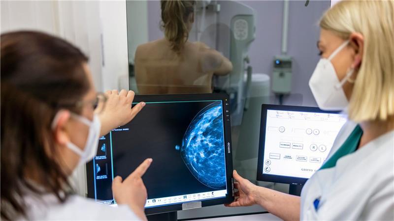 Mehr als 2.000 Frauen betroffen – Mammografie-Fehler empören Andalusien in Südspanien wird derzeit von einem Skandal um Fehler bei der Früherkennung von Brustkrebs erschüttert. Tausende Frauen erhielten ihre teils verdächtigen Befunde erst mit monatelanger Verzögerung. (Illustration)