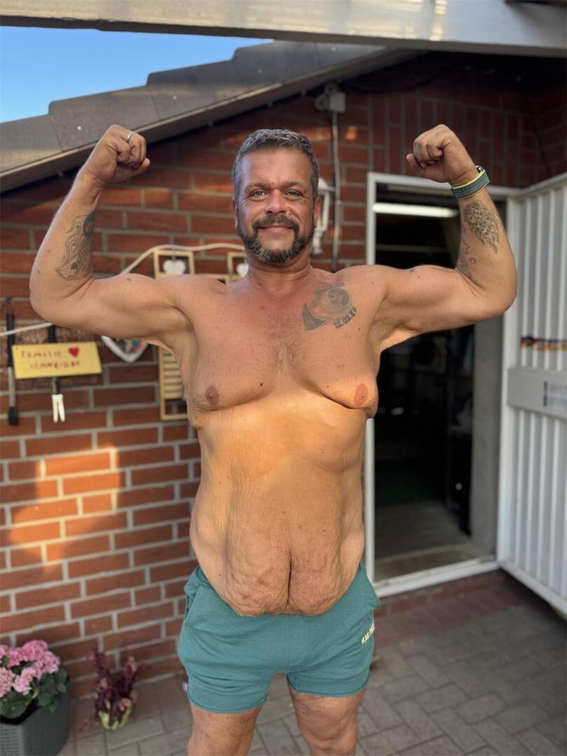 „Mein Fuß lag anderthalb Meter neben mir“: Bennys Kampf zurück Anfang 2025 zeigt die Waage fast 130 Kilogramm weniger an. Für Benjamin Schneider beginnt ein völlig neues Körpergefühl.