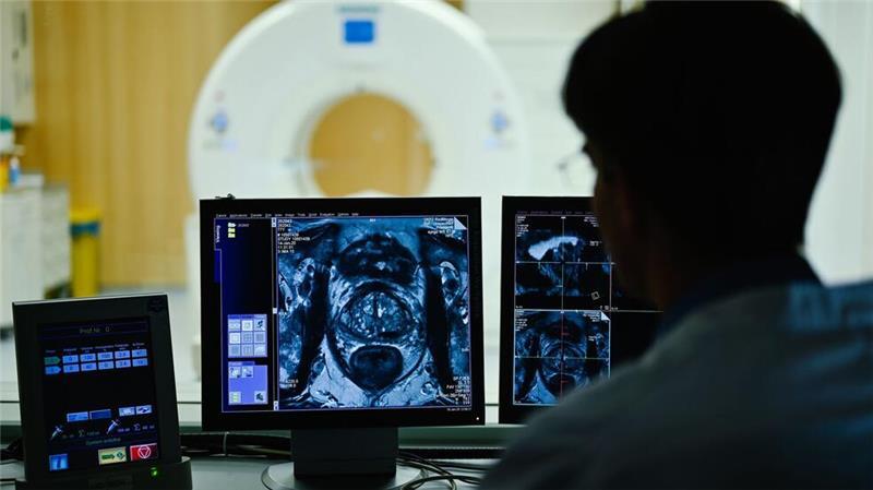 Auf dem Monitor ist das Querschnittsbild einer Prostata zu sehen: Prostatakrebs gehört zu den häufigsten Krebsarten bei Männern. (Archivbild)