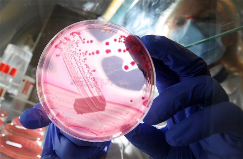 Auf der Petrischale mit einem speziellen Nährboden sind die EHEC-Bakterienstämme zu sehen. Symbolfoto: dpa