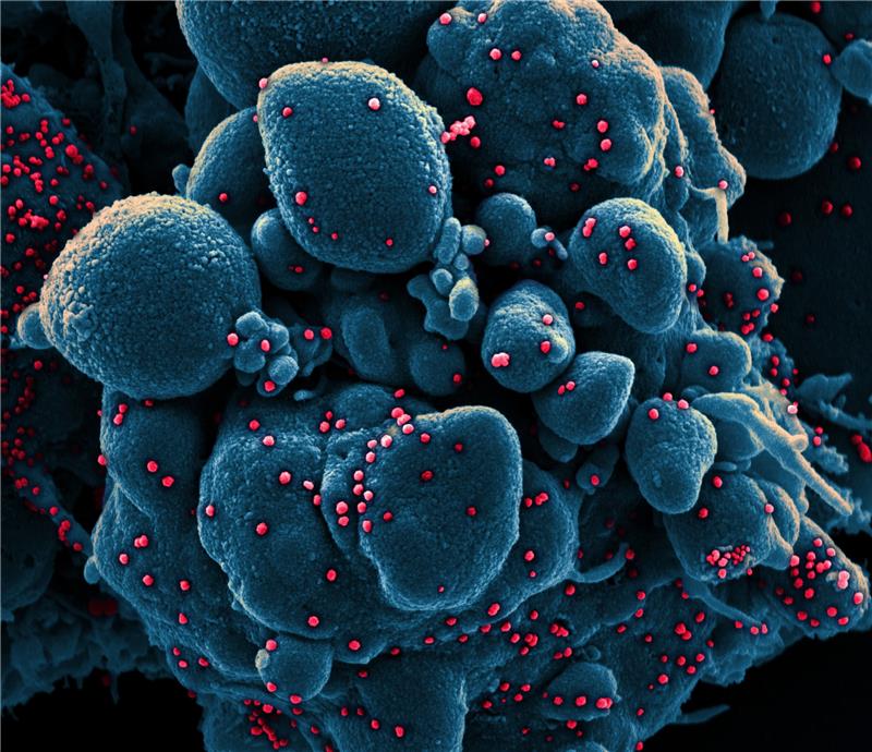 Auf dieser vom US-Forschungszentrum «National Institute of Allergy and Infectious Diseases» (NIAID) zur Verfügung gestellten Aufnahme ist eine Zelle (blau) mit dem Coronavirus (SARS-CoV-2, rot) infiziert. Foto: Niaid/Europa Press/dpa