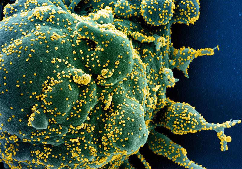 Auf dieser vom US-Forschungszentrum "National Institute of Allergy and Infectious Diseases" zur Verfügung gestellten Aufnahme vom 13. Februar 2020 ist eine Zelle (grün) mit dem Coronavirus (SARS-CoV-2, gelb) infiziert. Foto: Niaid/Europa Press/dpa