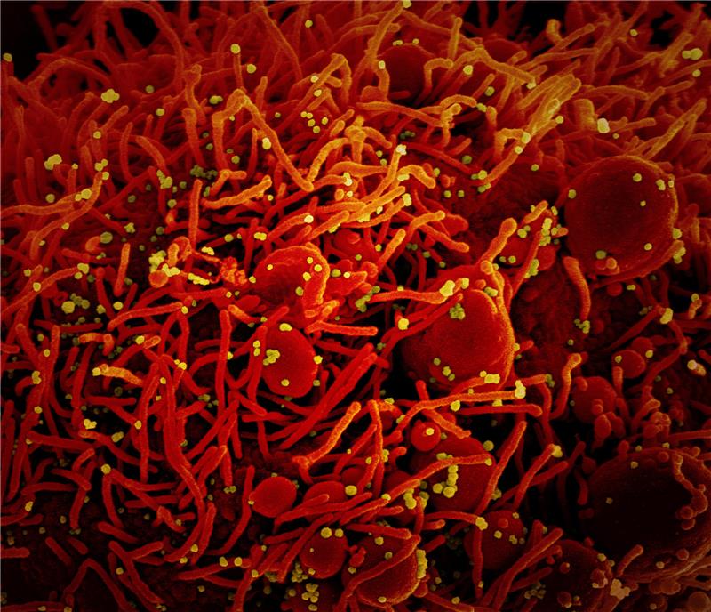 Auf dieser vom US-Forschungszentrum "National Institute of Allergy and Infectious Diseases" (NIAID) zur Verfügung gestellten Aufnahme ist eine Zelle (rot) mit dem Coronavirus (SARS-CoV-2, gelb) infiziert. Foto: Niaid/Europa Press/dpa