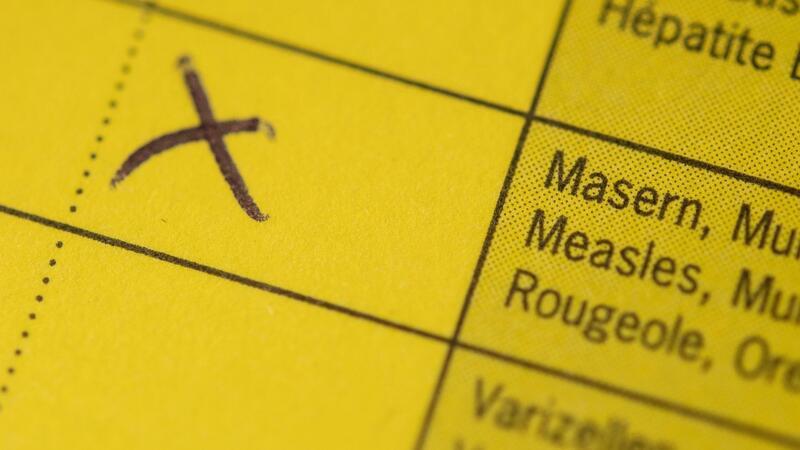 Auch 2024 dürfte es global gesehen viele Masernfälle geben Bei Masern handelt es sich laut RKI um eine der ansteckendsten Krankheiten beim Menschen überhaupt.
