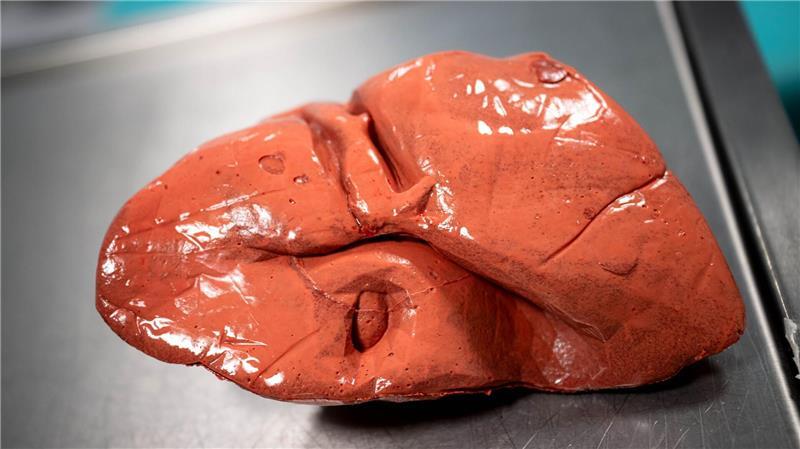 Bei komplizierten Eingriffen üben die Mediziner mit Organen aus dem 3D-Druck.