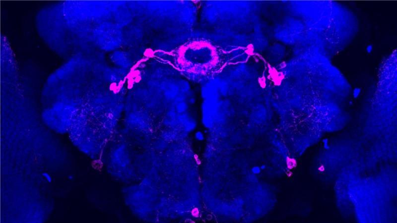 Ticken wir wie Fruchtfliegen? Im Schlaf vielleicht schon Bestimmte Hirnareale einer Taufliege wurden pink eingefärbt. In diesen Zonen werden visuelle Reize im Schlaf herausgefiltert, starke Reize kommen jedoch im Gehirn an.