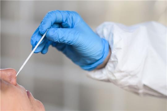 44 Covid-Patienten in den Elbe Kliniken