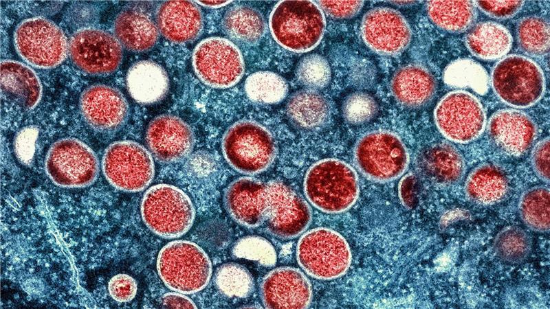 Bislang sieht das Robert-Koch-Institut keine Anzeichen zur Besorgnis.