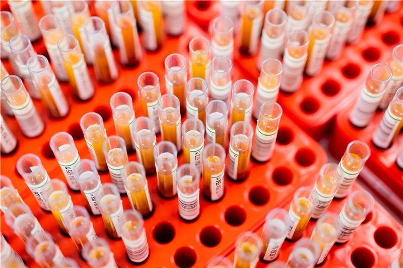 Kostenloser Corona-Antikörpertest für Blutspender – Was der Service bringt Blutproben von Spenderblut werden im Zentrallabor des DRK-Blutspendedienstes für Krankenhäuser und Praxen untersucht. Foto: Vennenbernd/dpa