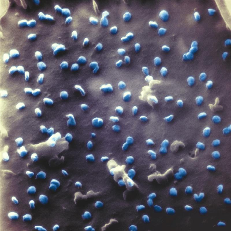 Coronaviren (blau) beim Austritt aus einer Nierenzelle, aufgenommen mit einem Heliumionen-Mikroskop. Foto: Natalie Frese/Universität Bielefeld/dpa