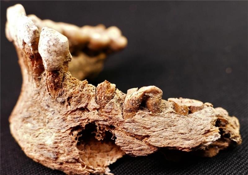 Das Bild zeigt die linke Seite des Unterkiefers von Anna Marlena Princk (1800-1842). Die Zähne wurden ihr noch vor der Hinrichtung mit brutaler Gewalt herausgeschlagen. Zähne und Knochen beweisen, dass sie seit ihrer Kindheit an Unterernähr