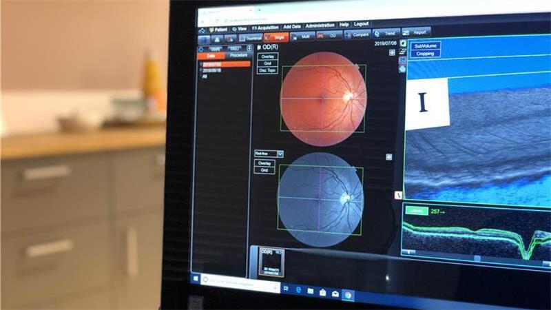 Netzhautschäden mithilfe der Optischen Kohärenztomografie frühzeitig erkennen Das Ergebnis ist sofort auf dem Bildschirm zu sehen.