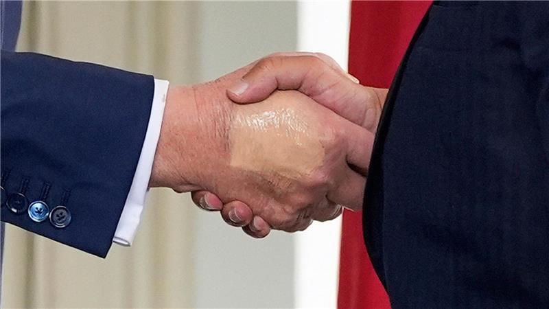 Weißes Haus: Trump hat chronische Erkrankung der Beinvenen Das Weiße Haus gibt Details zu Trumps Gesundheitszustand preis.