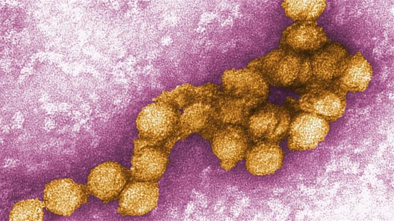 Mehr als 240 Fälle von West-Nil-Fieber in Europa Das West-Nil-Virus unter dem Elektronenmikroskop.