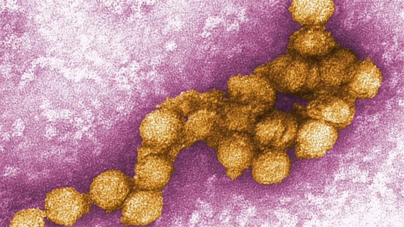 Fast 1.600 West-Nil-Fälle in Europa registriert Das West-Nil-Virus unter dem Elektronenmikroskop. (Archivbild)