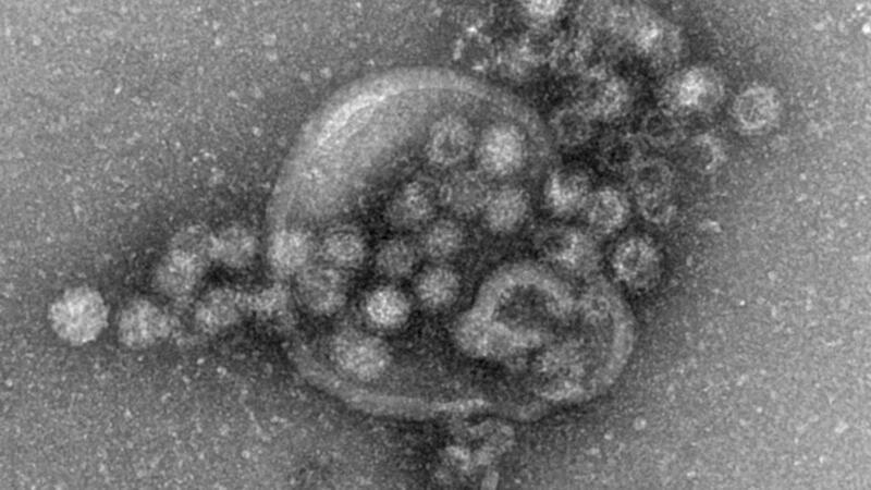 Norovirus am Gardasee - Hunderte Menschen im Krankenhaus Das hochansteckende Norovirus verursacht einen plötzlich auftretenden, heftigen Brechdurchfall.