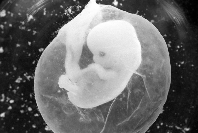 Das undatierte Foto zeigt einen sieben Wochen alten Fötus in einer Fruchtblase. Foto: Peter Endig/dpa