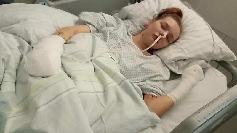 Der 22-jährigen Kira Sondermann mussten wegen einer kritischen Durchblutungsstörung alle Finger und weitere Gliedmaßen entfernt werden. Das Foto wurde von der Familie zur Verfügung gestellt.