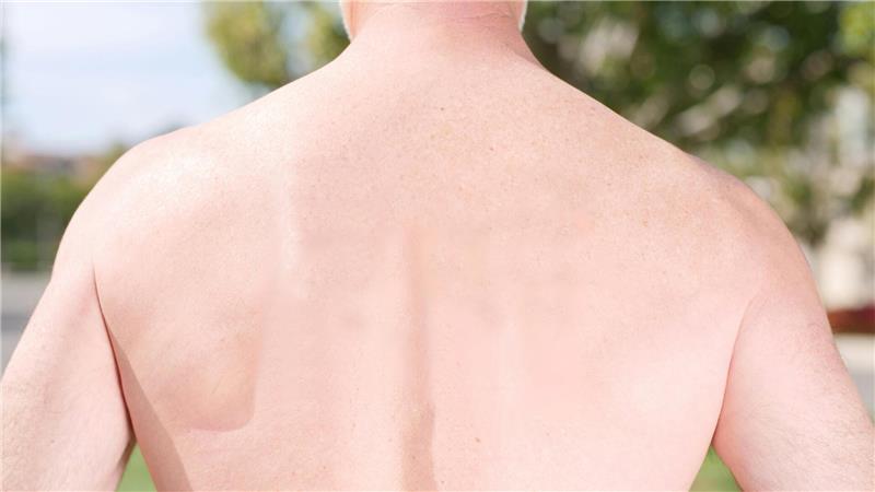 Der nackte Mann am See im großen Moor war nach Angaben der Spaziergängerin zwischen 60 und 70 Jahre alt (Symbolbild).