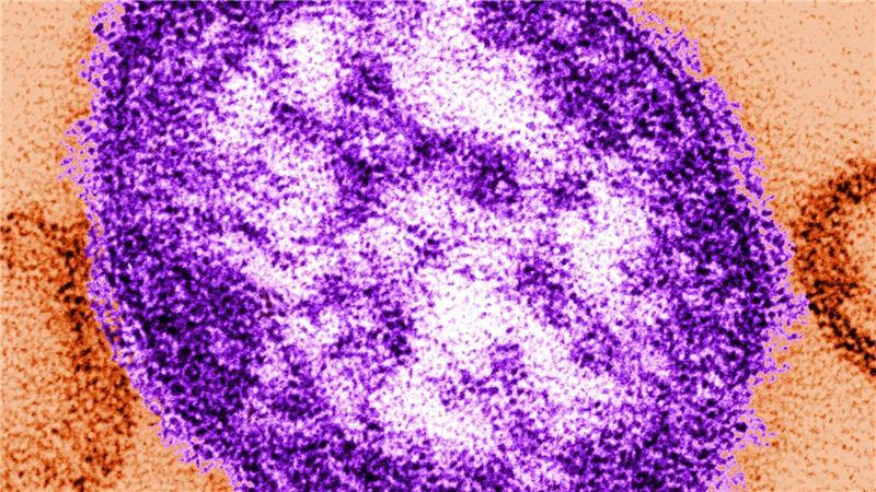 Die Abbildung mit Hilfe eines Transmissionselektronenmikroskops zeigt Teile eines Masernvirus