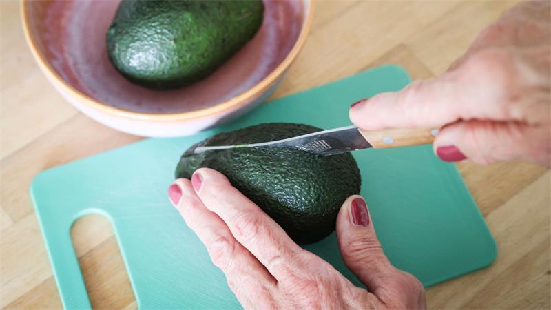 „Avocado-Hand“-Fälle am UKSH steigen – Mehr Frauen betroffen Die Avocado sollte beim Schneiden nicht in der Hand gehalten werden.