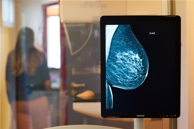 Die Brust einer Frau ist auf einer Röntgenaufnahme zu sehen. Foto: Klaus-Dietmar Gabbert/zb/dpa