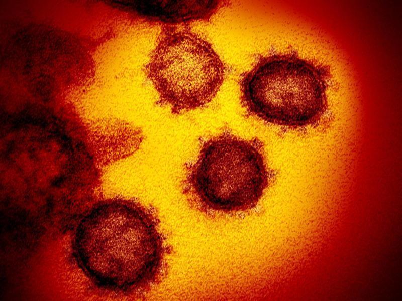 Die Elektronenmikroskopaufnahme zeigt das Coronavirus SARS-CoV-2. Foto: Niaid-Rml/ZUMA Wire/dpa