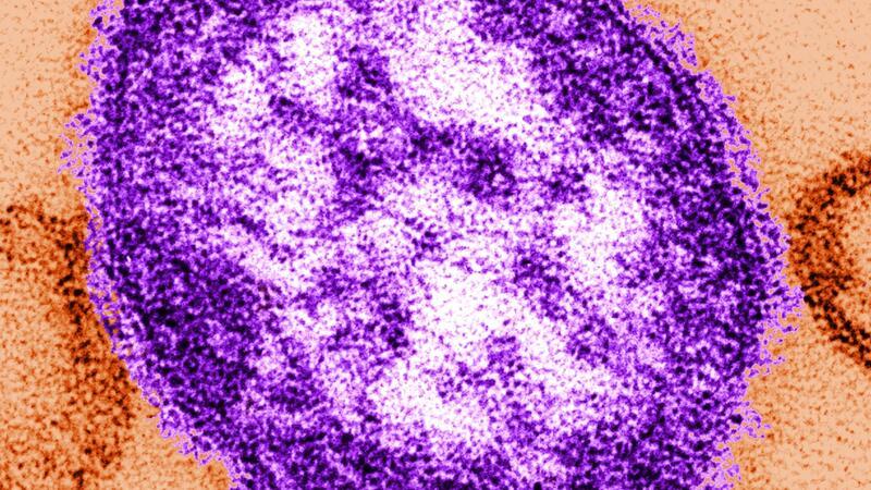 Britische Behörde besorgt wegen Häufung bei Masern Die Masern gehören zu den ansteckendsten Infektionskrankheiten überhaupt.