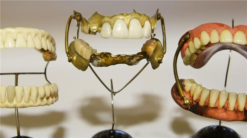 Die Polizei ermittelte nach dem Diebstahl eines Gebisses. (Symbolfoto) 