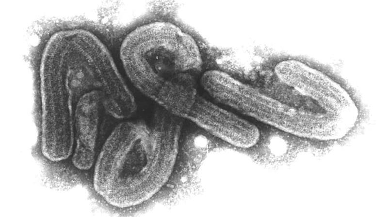 Tansania räumt Todesfall durch Marburg-Virus ein Die Präsidentin sagte, Tansania habe aus dem Marburg-Ausbruch 2023 gelernt. (Archivbild)