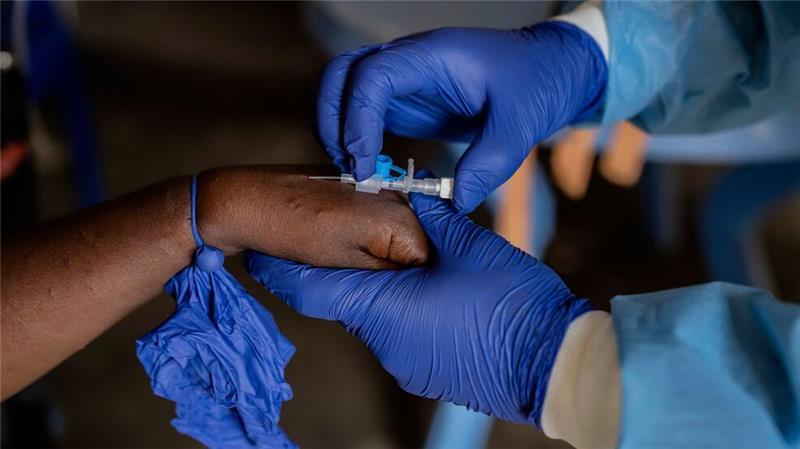 Kongo beginnt mit Mpox-Impfungen Die Zahl der Mpox-Fälle nimmt in mehreren afrikanischen Ländern weiter zu (Archivbild).