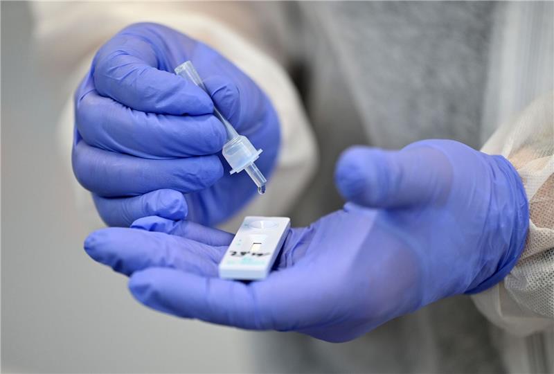 Die Zahl der PCR-Tests auf das Coronavirus ist weiter rückläufig. Foto: dpa-Bildfunk