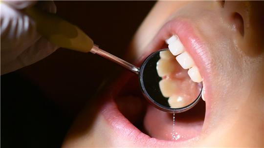 Die Zahl der Zahnarztpraxen in Hamburg ist gesunken. (Symbolbild)