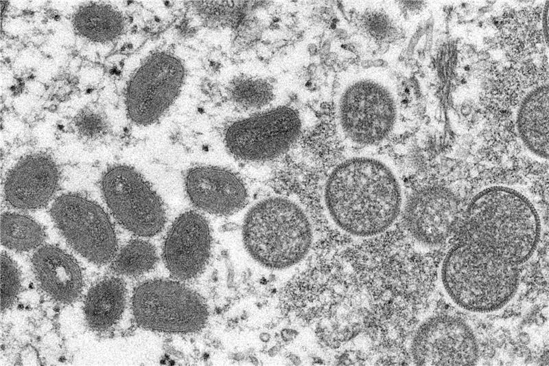 Diese elektronenmikroskopische Aufnahme aus dem Jahr 2003, die von den Centers for Disease Control and Prevention zur Verfügung gestellt wurde, zeigt reife, ovale Affenpockenviren (l) und kugelförmige unreife Virionen (r), die aus einer menschlichen Hautprobe stammt. Foto: Cynthia S. Goldsmith/Russell Regner/CDC/AP/dpa