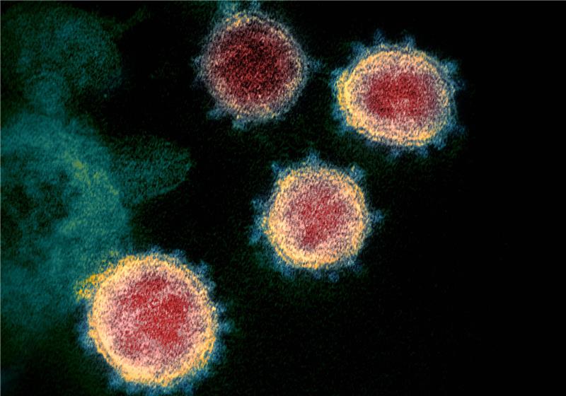 Diese undatierte elektronenmikroskopische Aufnahme, die von den U.S. National Institutes of Health im Februar 2020 zur Verfügung gestellt wurde, zeigt das neuartige Coronavirus (SARS-CoV-2), das Covid-19 verursacht. Foto: NIAID-RML/AP/dpa 