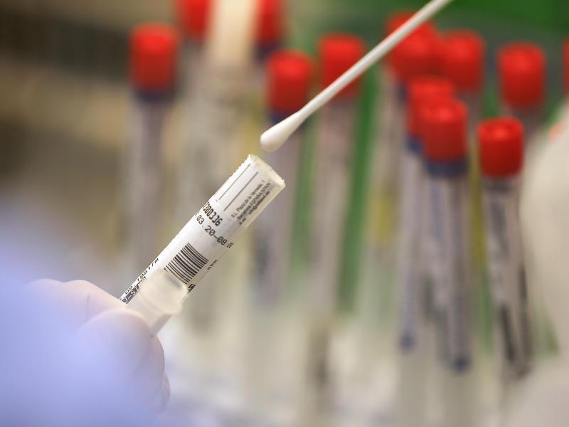 Ein Abstrich wird in einem Labor auf das Coronavirus untersucht. Foto: Oliver Berg/dpa/Symbolbild