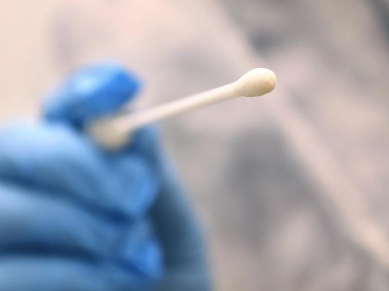 Ein Arzt hält einen Tupfer, mit dem ein Abstrich für einen Coronatest gemacht wird. Foto: Karl-Josef Hildenbrand/dpa/Symbolbild
