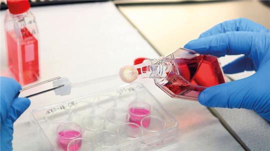 Ein Augenhornhaut-Transplantat wird von einem Labormitarbeitenden bearbeitet.