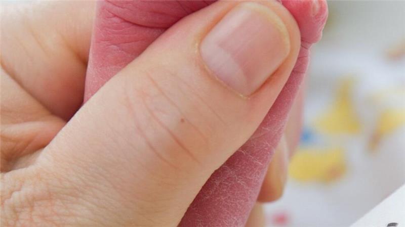 Ein Bluttropfen vom Fuß eines Babys genügt, um viele Krankheit zu erkennen. (Archivbild)