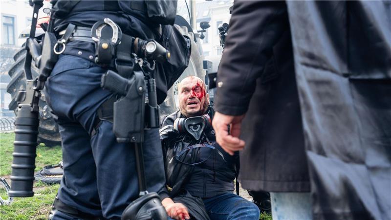 Ein Demonstrant sitzt verletzt auf einem Bordstein. 