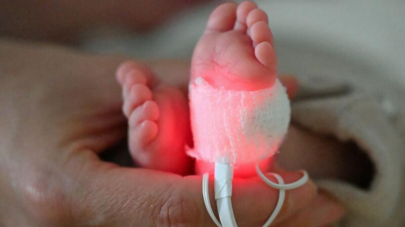 Ein Frühchen ist in einem Bremer Krankenhaus gestorben. Grund ist eine Infektion, die durch ein Bakterium verursacht wurde. (Symbolbild)