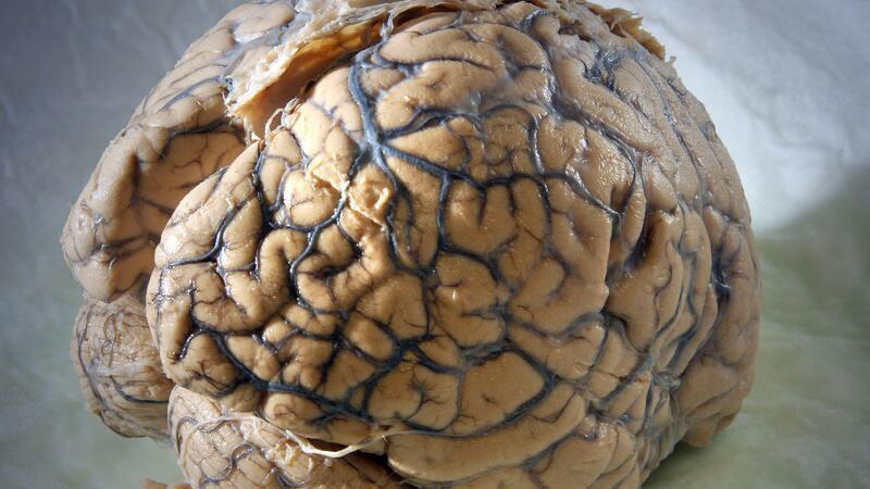 Gehirnatlas: Mensch hat über 3000 verschiedene Hirnzelltypen Ein Gehirn des Menschen in einem Labor der Klinik für Neurologie am Universitätsklinikum Jena.