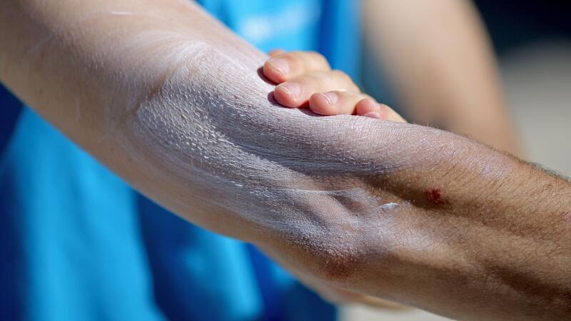 Ein Mann verreibt Sonnencreme auf seinem Arm. Einer aktuellen Umfrage zufolge nutzt gut ein Drittel aller Befragten im Frühjahr und Sommer normalerweise kein Sonnenschutzmittel.