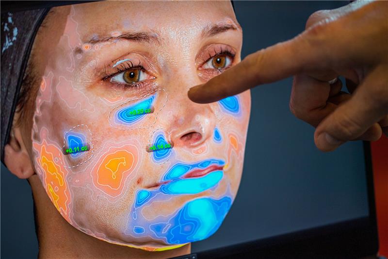 Ein Mann zeigt bei der 49. Jahrestagung der Deutschen Gesellschaft für Ästhetisch-Plastische Chirurgie (DGÄPC) auf einem Bildschirm auf das Gesicht einer Frau, auf dem die spezielle 3D-Software Vectra des Herstellers Canfield ästhetisch-plastisch behandelte Stellen erkannt hat (Einfärbungen). Foto: Lino Mirgeler/dpa