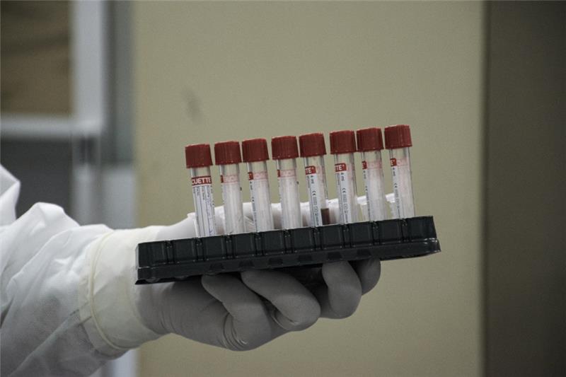 Ein Mitarbeiter eines Labors hält Abstrichproben von Coronapatienten in der Hand. Foto: dpa