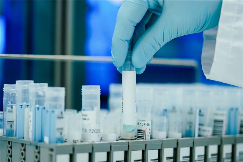 Corona-Test ist abgelaufen – trotzdem noch verwenden? Ein Mitarbeiter hält in einem Coronatest-Labor PCR-Teströhrchen in den Händen.